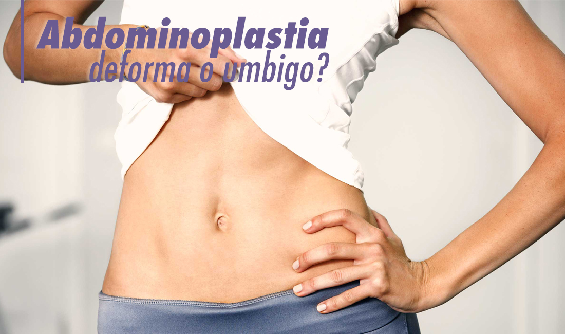 Abdominoplastia deforma o umbigo? Abdominoplastia deforma o umbigo?