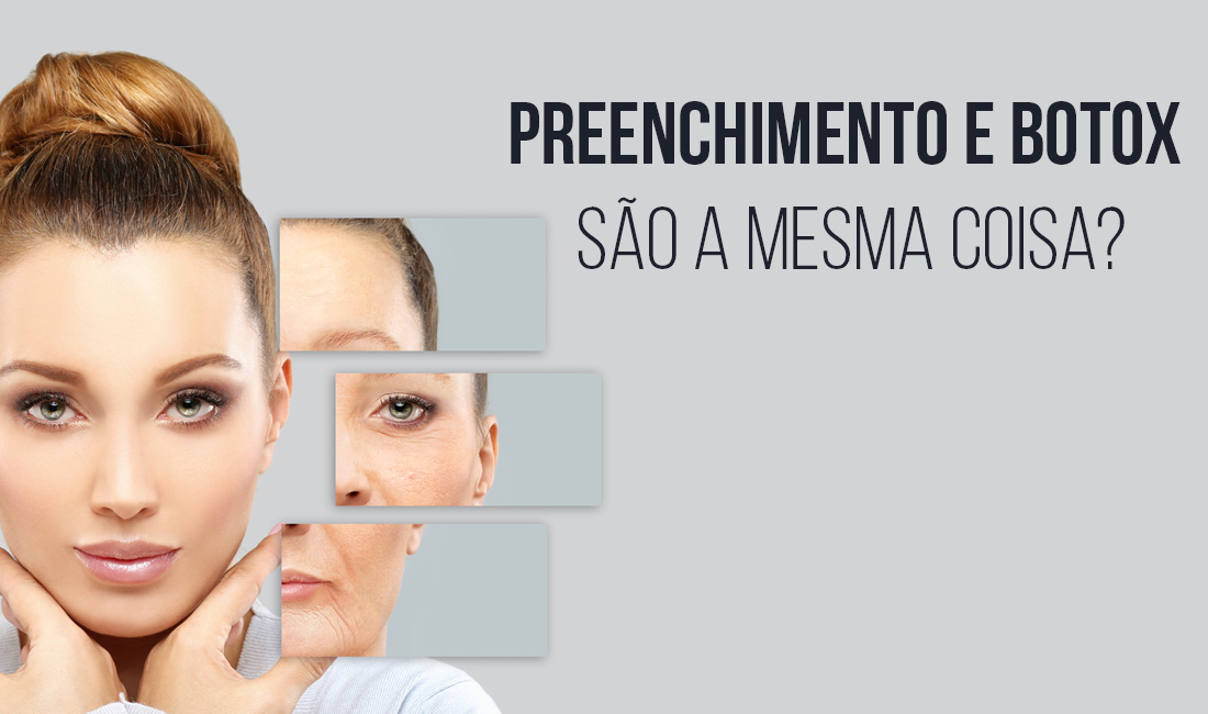 Preenchimento e botox são a mesma coisa? Preenchimento e botox são a mesma coisa?