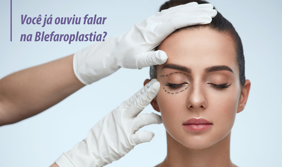 Você já ouviu falar na blefaroplastia? Você já ouviu falar na blefaroplastia?