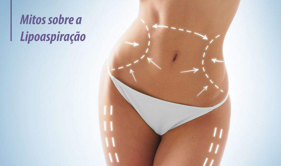 Mitos sobre a lipoaspiração Mitos sobre a lipoaspiração