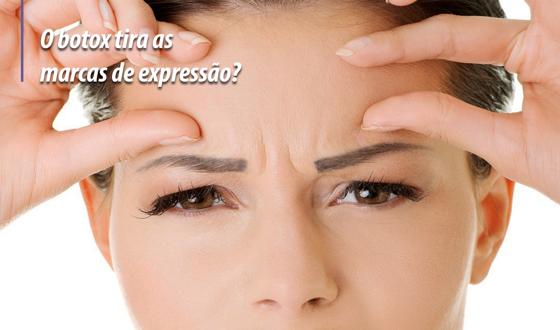 Botox tira a expressão? Botox tira a expressão?