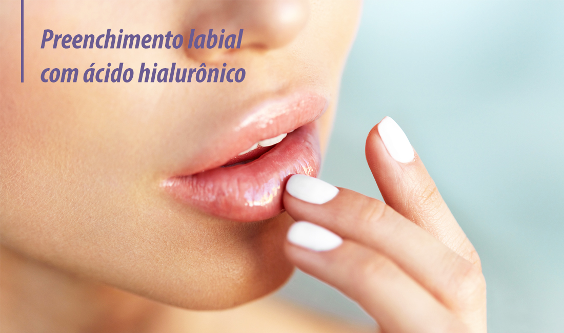 Preenchimento labial com ácido hialurônico Preenchimento labial com ácido hialurônico