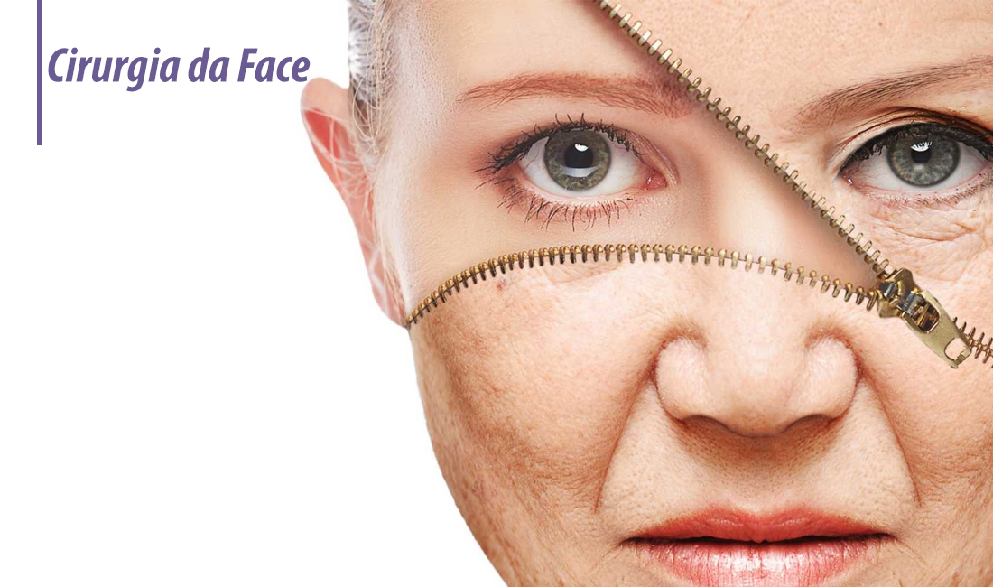 Quanto tempo dura o lifting facial? Quanto tempo dura o lifting facial?