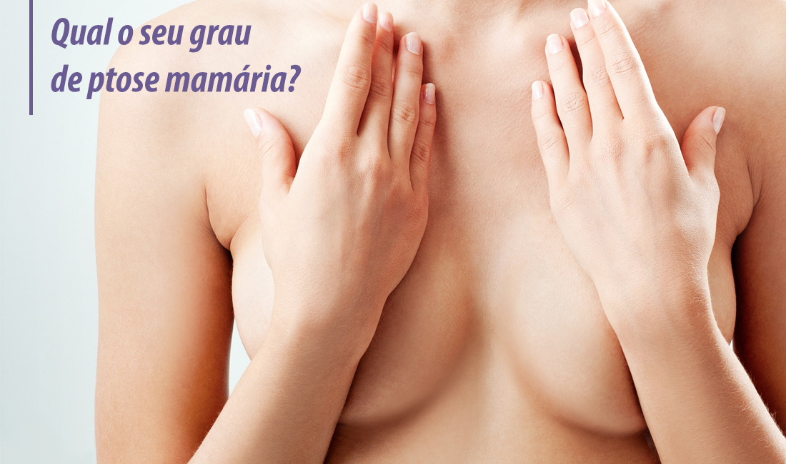 Qual o seu grau de ptose mamária? Qual o seu grau de ptose mamária?
