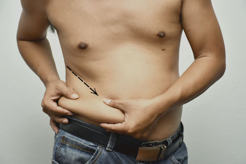 cirurgia-para-homens