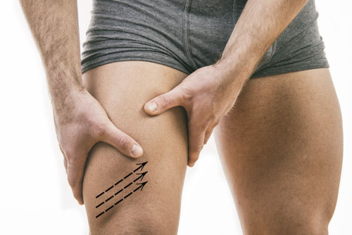 cirurgia-para-homens