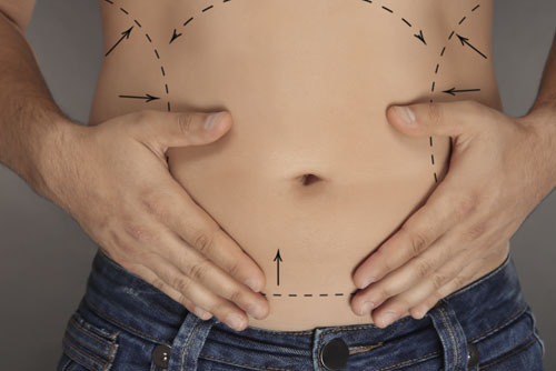 cirurgia-para-homens