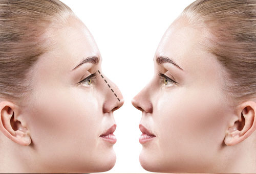 cirurgia-da-face